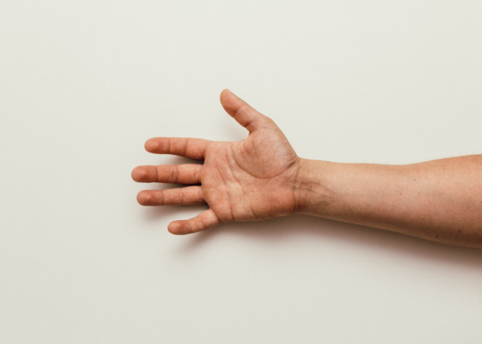 Carpal Tunnel Syndrome (CTS)